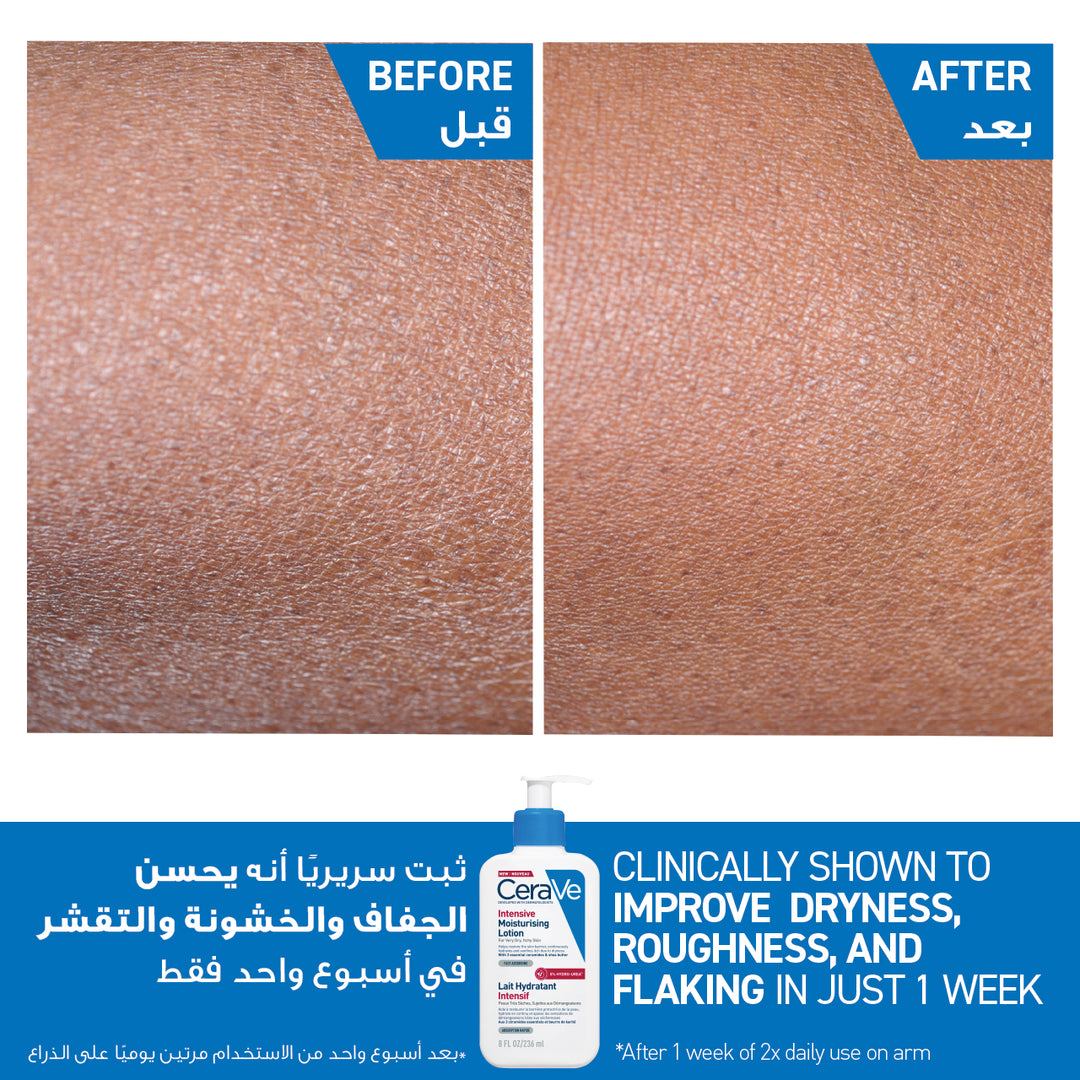 CeraVe Intensive Moisturising Lotion for Very Dry Skin 236ml