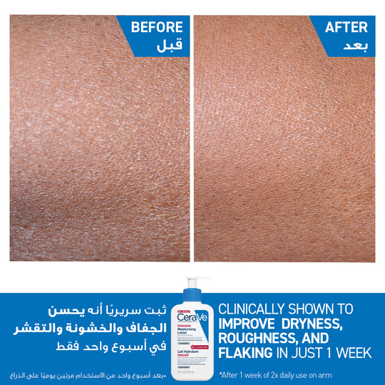 CeraVe Intensive Moisturising Lotion for Very Dry Skin 236ml