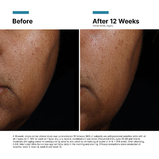 SkinCeuticals A.G.E Interrupter Ultra Skin Lifting & Tightening Serum 30ml
