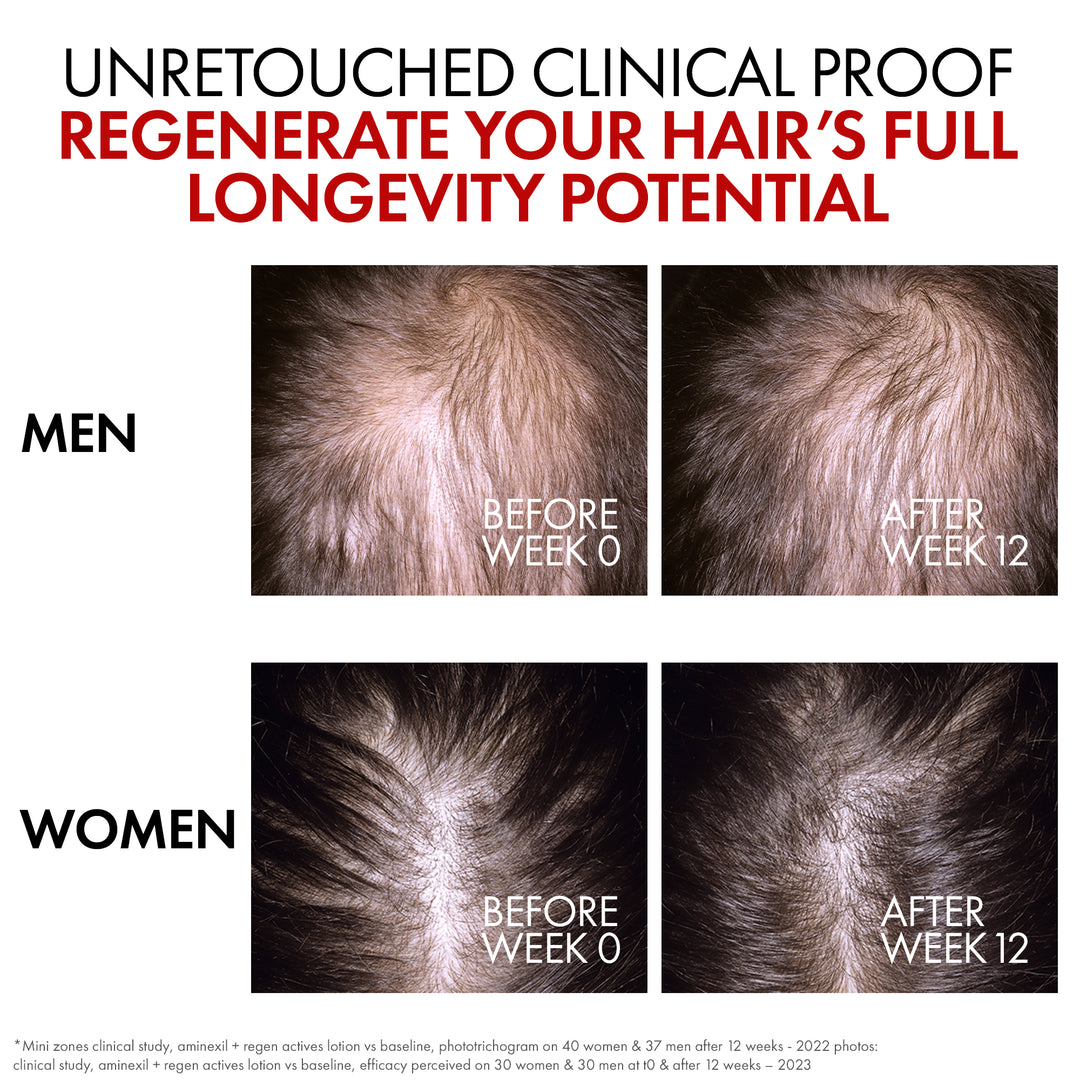 Vichy Dercos Aminexil Clinical REGEN Booster 90ML