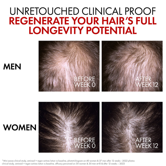 Vichy Dercos Aminexil Clinical REGEN Booster 90ML