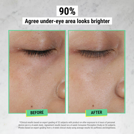 Avocado Eye Cream - MYHOLDAL LEBANON