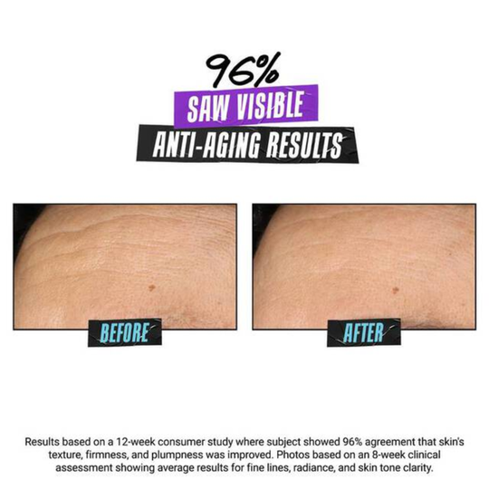 Super Multi Corrective Soft Cream - MYHOLDAL LEBANON
