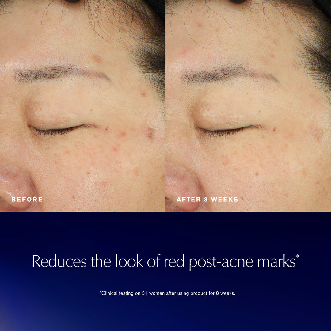 Advanced Night Repair Recovery Treatment Essence