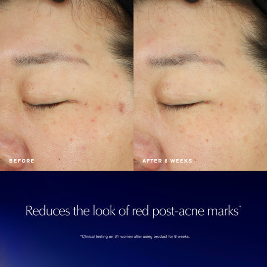 Advanced Night Repair Recovery Treatment Essence