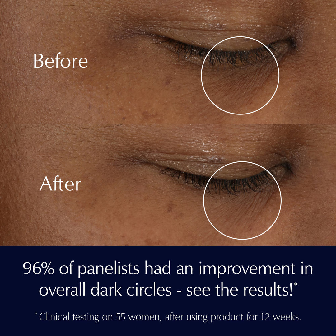 Advanced Night Repair Eye Supercharged Gel-Creme
