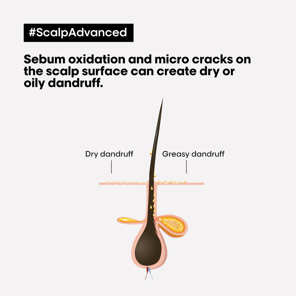 Scalp Advanced Anti-Dandruff Dermo-Clarifier Shampoo | For Dandruff Scalps |Serie Expert | 300 Ml